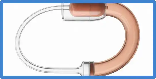 jejunostomy, feeding jejunostomy, jejunostomy tube, jejunostomy feeding tube, j tube